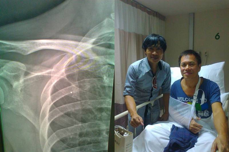 รูปภาพ